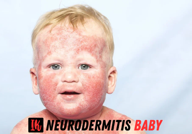 Neurodermitis Baby: Ursachen, Symptome und moderne Behandlungsmöglichkeiten für empfindliche Babyhaut Neurodermitis Baby
